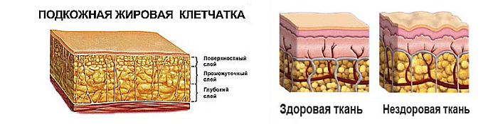 Состав гиподермы