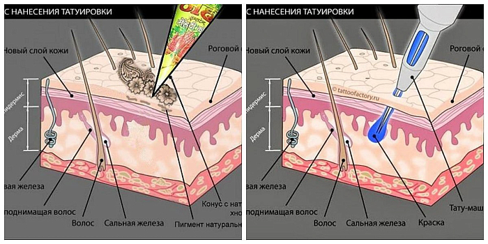 Проникновение лазера под кожу